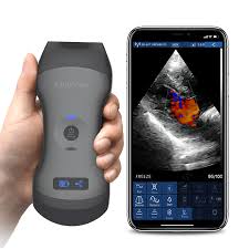 Hand Held Ultra Sound Scan